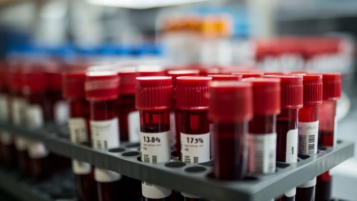 Biomarkery – jak pomagają w diagnozie i leczeniu chorób?