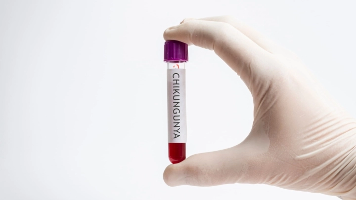 Chikungunya – tropikalna gorączka wirusowa. Objawy, profilaktyka i leczenie