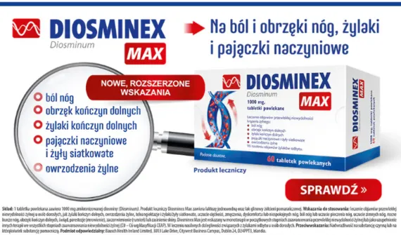 Ciężkie i bolące nogi – objawy przewlekłej niewydolności żylnej