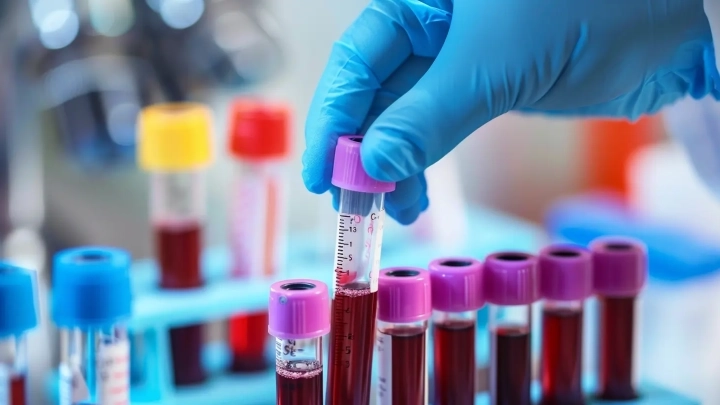 Jak obniżyć poziom cholesterolu?