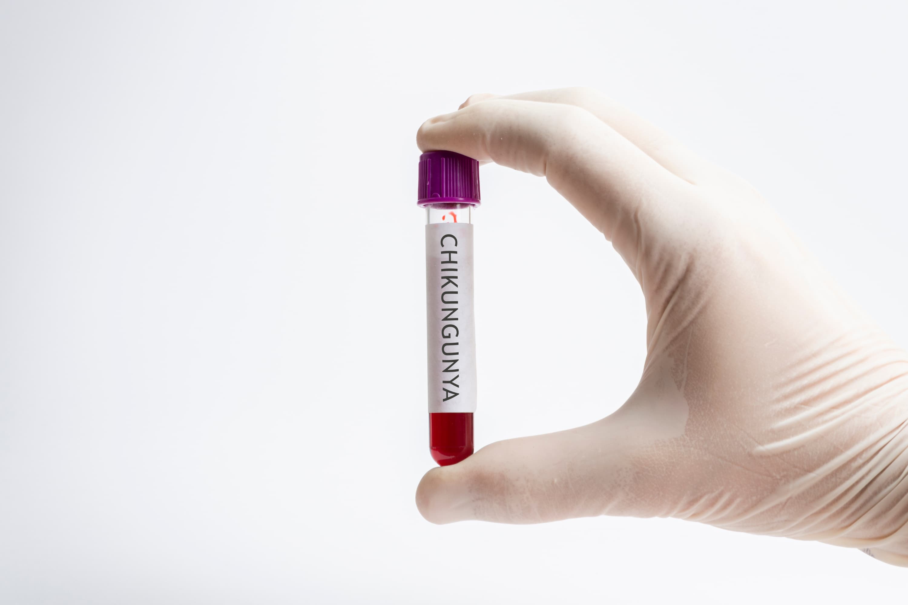 wirus chikungunya