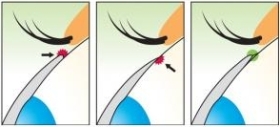 Eyeye Bioxy soczewki -4,50 3 szt.