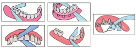 PIKSTERS X-Ribbon gaza dentystyczna do czyszczenia implantów i mostów 12 m